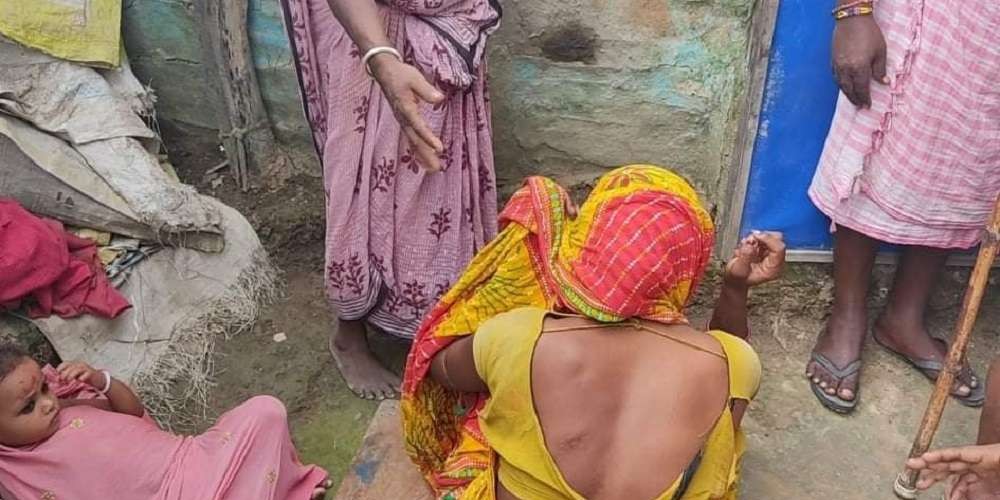 महोत्तरीमा घरभित्रै पसेर दलित महिलामाथि साहुले गरे कुटपिट, प्रहरीले लिएन उजुरी